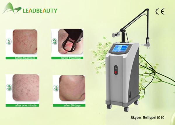 2016 new products fractional co2 laser skin resurfacing machine from china