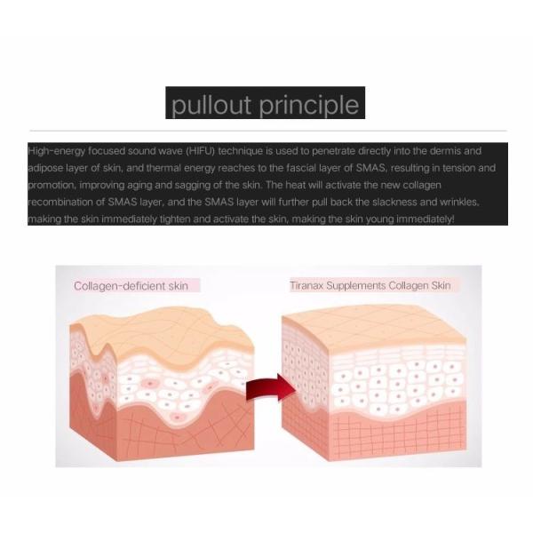 Salon / Home Use HIFU Facelift Machine High Efficiency Non Surgical Treatment