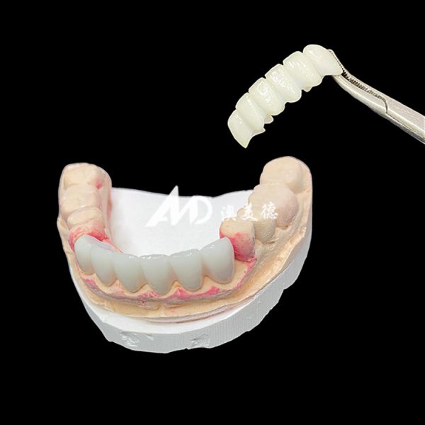 Zirconia Dental Crown with High-Quality Materials and Precise Laboratory Fabrication for Long-Lasting, Esthetic Restorations