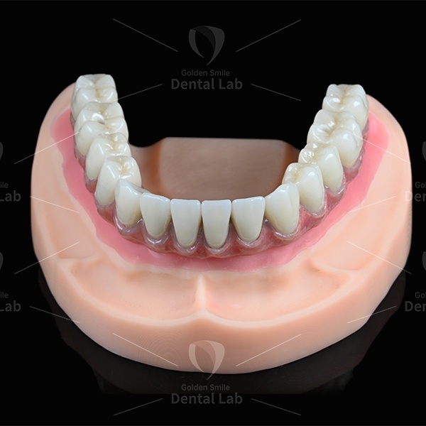 Implant PFM Crown Co-Cr Screw Retained Dental Crown And Bridge