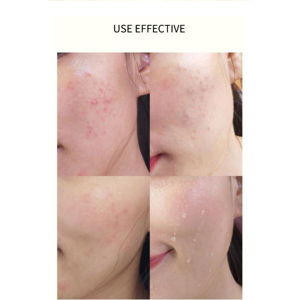 Витамин C и Hyaluronic кисловочная сыворотка разводя Hyaluronic кисловочную сыворотку водой