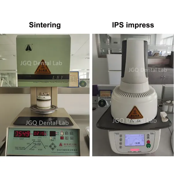 Dental Lab Durability Implants Make Cost-Effective Option in The Long Run