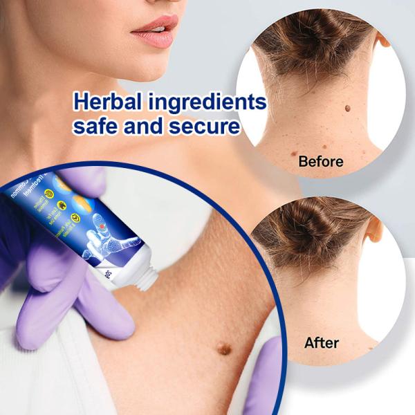 Odorless Instant Blemish Remover Gel Warts Treatment Cream For Any Skin