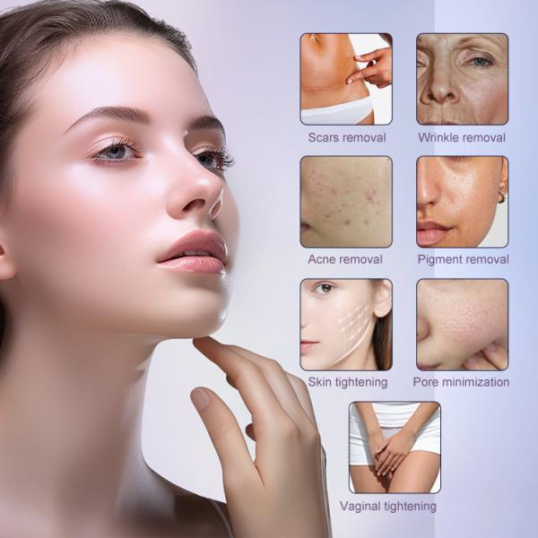 Máquina láser fraccionada de CO2 para la eliminación de pecas de cicatrices Máquina de corte láser de CO2 para uso doméstico Equipo de belleza