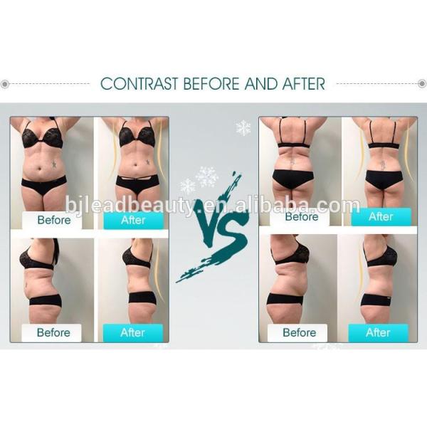 Leadbeauty Manufacturer CE Approval Fat Reduce Cryo lipolysis Slimming Machine