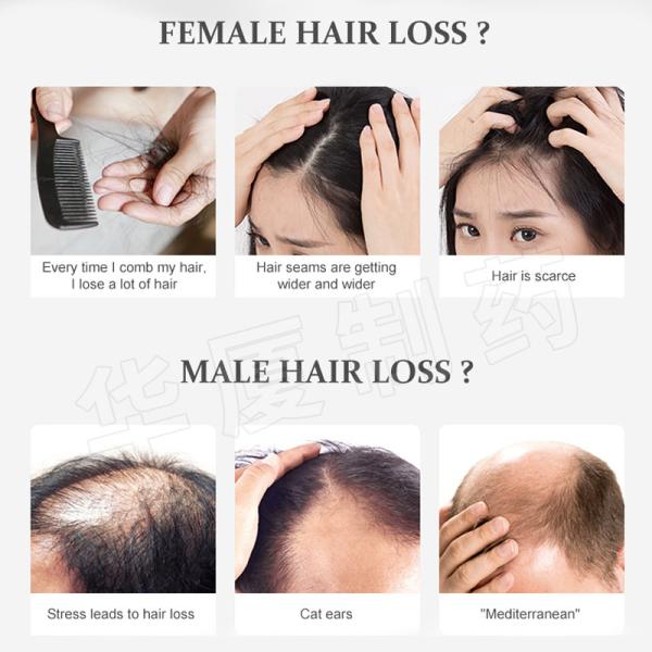 Hair Shampoo Hair Hair Conditioner Shampoo Hair Care Products 100% Pure Natural Hair Shampoo Anti-hair Loss Ginger Shamp