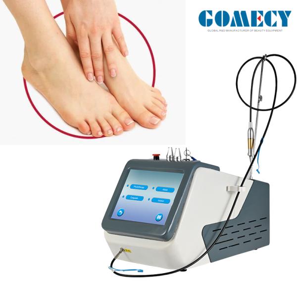 Клиническая лазерная машина для педикюра грибков ногтей, устраняющая ЛВД, утверждена