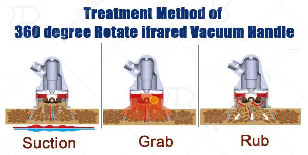Máquina de Terapia de RF de Roller de Esferas Interna 2 em 1 Redução da Celulite Aprietação da Pele