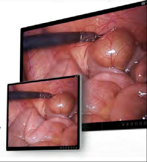 19in FHD Moniteur Chirurgical 4K Endoscope Caméra Anti-éblouissement BTH-9100