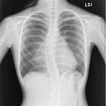 10 X 12 Inch X Ray Medical Imaging