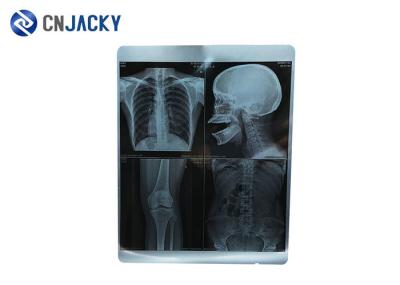 100 Sheet / Pack X Ray 44m Medical Radiation Printing Film