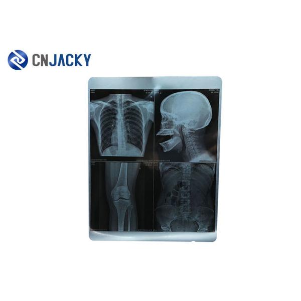 100 Sheet / Pack X Ray 44m Medical Radiation Printing Film