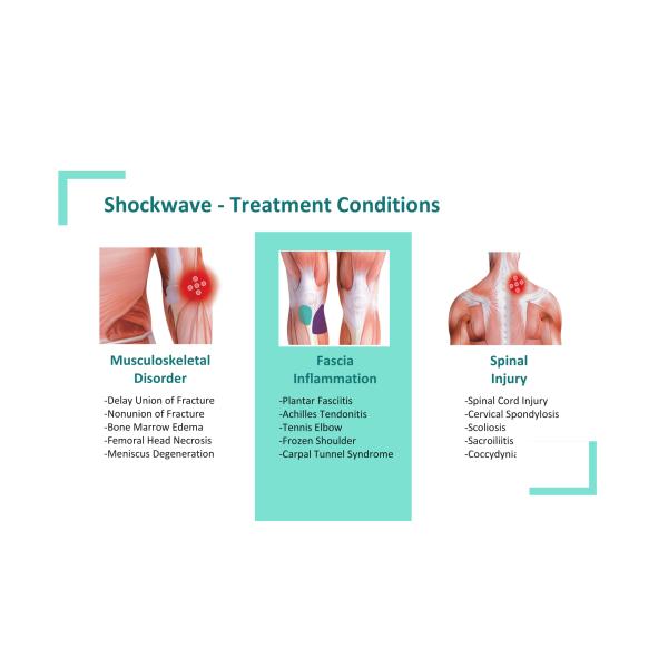 Ультразвуковое устройство пневматической ударной волны, терапия спортивная реабилитация, обезболивающее устройство Eswt