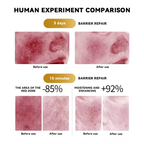 Medical Recombinant Collagen Repair Patch Sterile Post Procedure Dressing Wound Healing