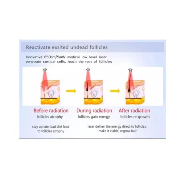 5mw/Pcs Medical Laser Hair Growth Caps LLLT Led Hair Growth Helmet