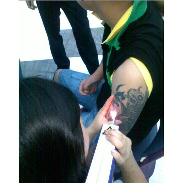 tatoo removal nd yag laser,portable q switched nd yag laser beauty machine price