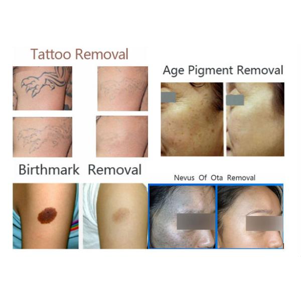 YAG IPL Laser Machine