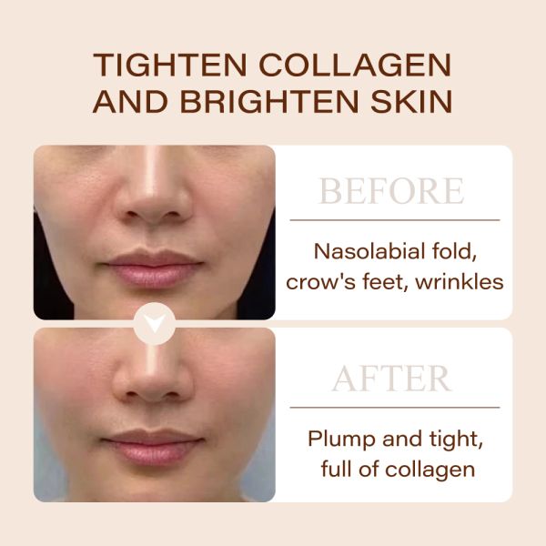 Bifid Yeast Anti-Aging Serum Hyaluronic Acid Serum Moisturizing Face Anti-Wrinkle Repair Whitening Essence  for Skin Care