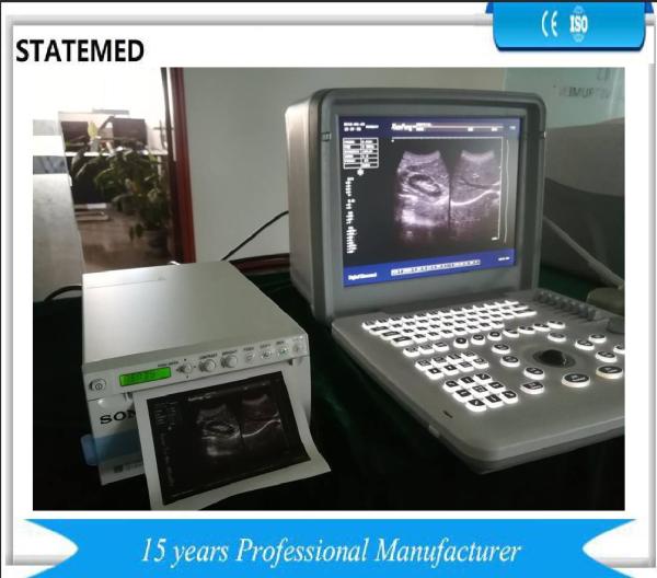 Black White Portable Ultrasound Scanner Equipment For Obstetrics / Gynecology