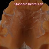 Las clavijas de dentaduras parciales acrílicas transparentes removibles conservan el aspecto natural