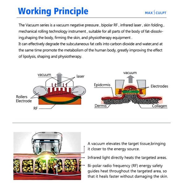 Machine de réduction de graisse par radiofréquence et cavitation sous vide VelaBody, machine de remodelage corporel et de perte de poids sous vide