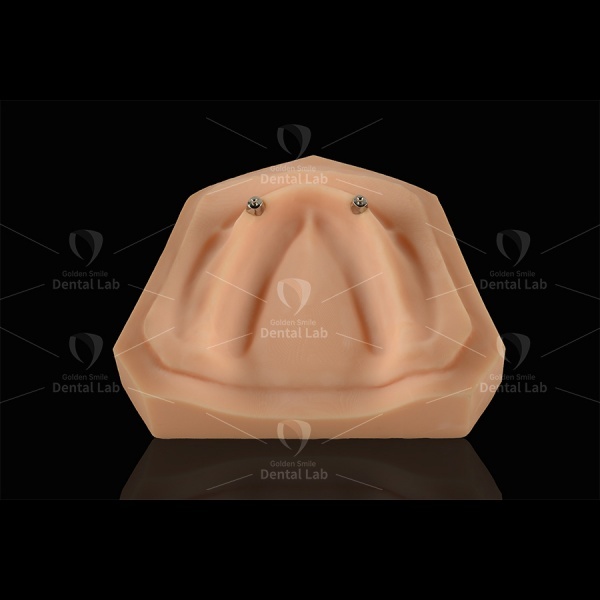 Root Preservation Dental Implant Parts Metal Protection Cap With Post