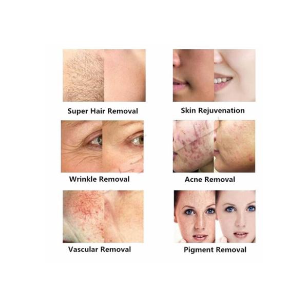 360 Magneto Optic Multifunction Skin Care Machine Two Handles Non Surgical