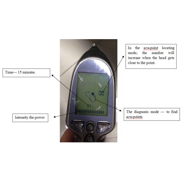 Черный под анализатор здоровья с зондами пусковых площадок топления электрода для стимулирования иглоукалывания