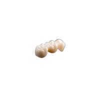 Vista a coroa dental cerâmica natural Rich Manufacturing Experience Comfortable