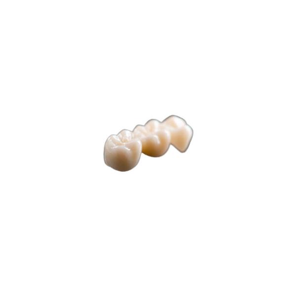 Vista a coroa dental cerâmica natural Rich Manufacturing Experience Comfortable