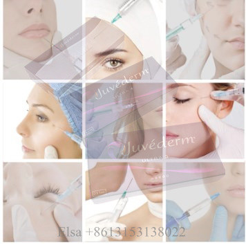 Juvederm Ultra4 Dermal Filler Lip filler Лифтинг лица с гелем для инъекций