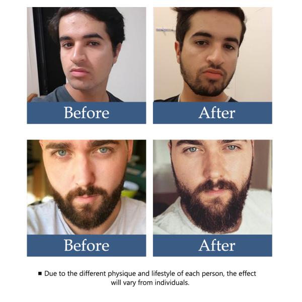 ODM Moisturizer Beard Growth Essential Oil Hair Growth Serum