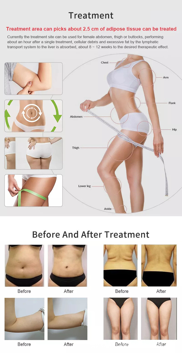 Уменьшение целлюлита машины 0.8cm 1.3cm красоты ультразвука HIFU Liposonic