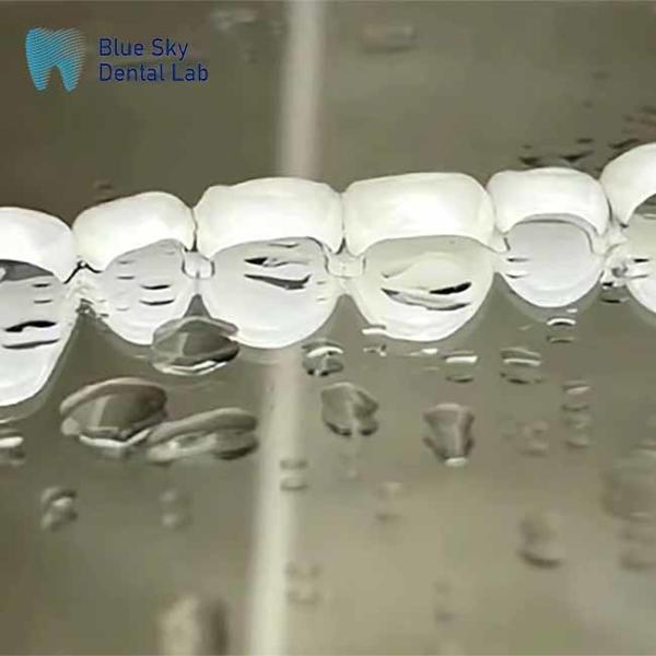 Las carillas ultrafinas E Max Ingot Clase Cerámicas de aspecto natural