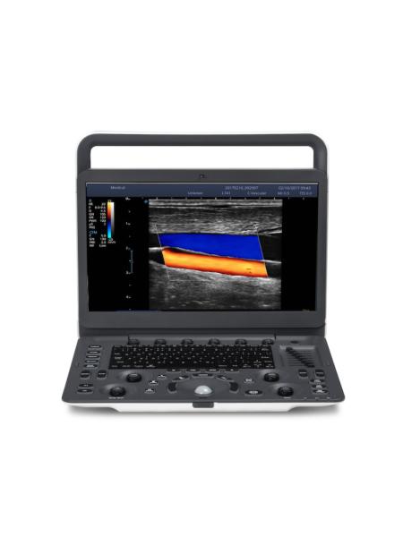 15.6'' LCD Sonoscape E2 Ultrasound Machine With 2 Year Warranty
