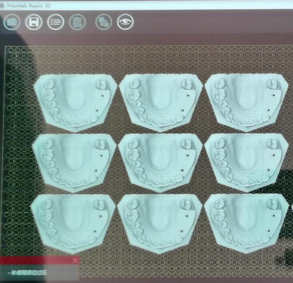 High Accuracy Resin 3d Printing Machine High Precision Orthodontic SLA