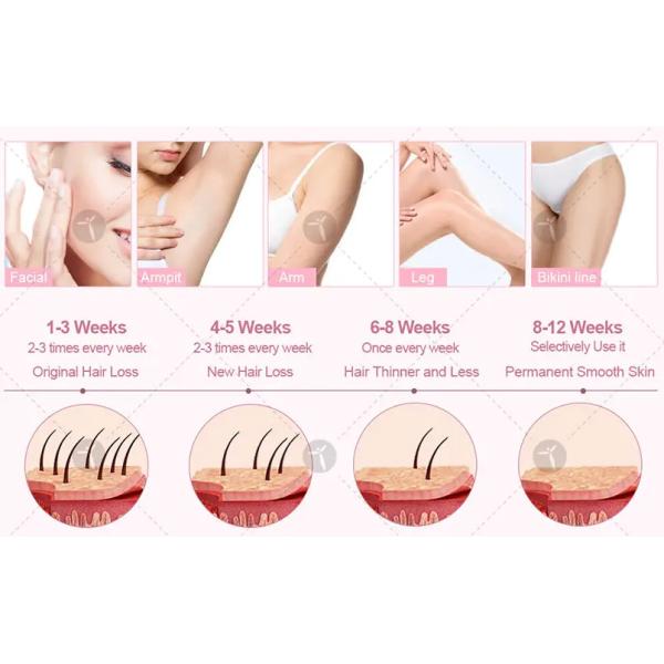 Vertical Ipl Wavelength 640nm Opt Hair Removal Machine