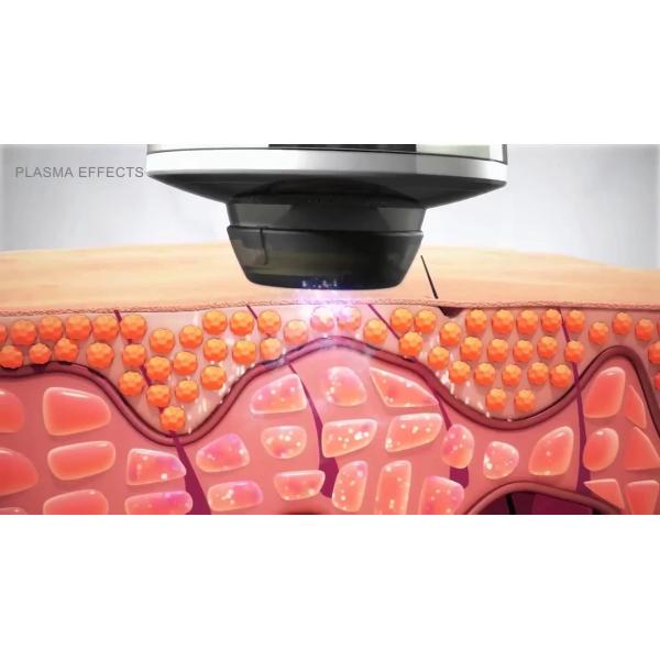 AC100-240V Multifunctional Beauty Machine Plasma Pen For Beauty Salon