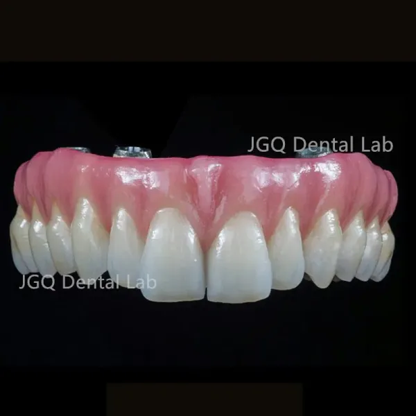 Zirconia Dentures Teeth Dental Lab Single Crown Anterior Posterior Dental Restoration