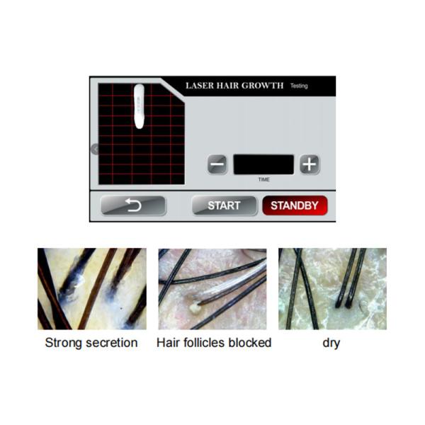650 Нм диодная лазерная машина для роста волос Анализатор низкого уровня терапии волос