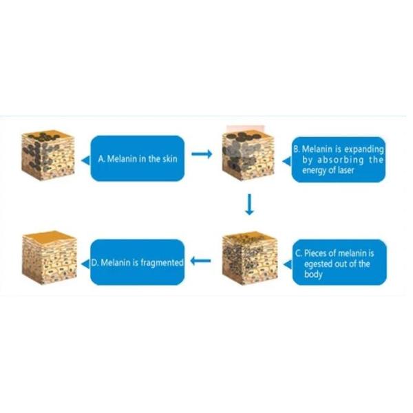 Q Switch Nd Yag Laser Equipment , Eyebrow / Freckle / Tattoo Removal Machine