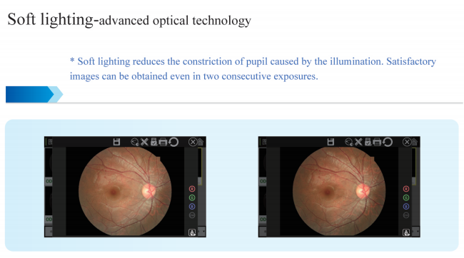 Ультра широким тип автоматизированный полем Fundus камеры оборудование фотографии b с FFA