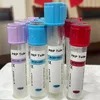 Siny Disposable Medical Beauty Clinic Vacuum Blood Collection Tube Prp Tubes Prf Kit Tube ISO