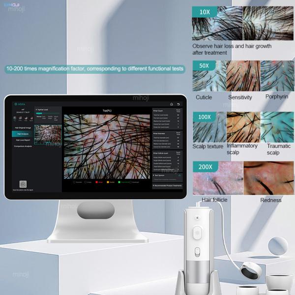 16 Million HD Lenses Skin Hair Analyzer Machine For Head Revitalization