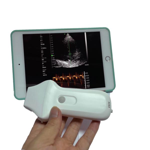 Portable Hand Held Used Cheap Phased Array Ultrasound Machine Probe