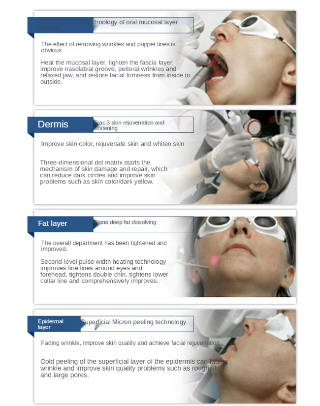 4D Fotona Pro CO2 Fractional 10600nm 2940nm ER Laser Skin Beauty Machine