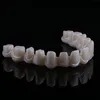 Dental Implant Screw Retained Crowns Titanium Bar Implant Supported Hybrid Denture