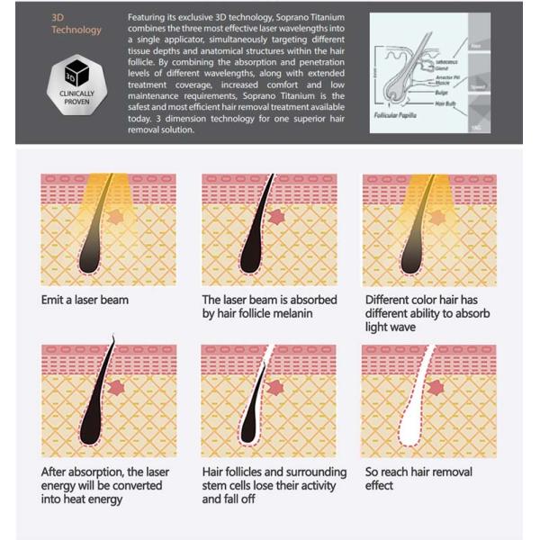 LCD Display OPT SHR Hair Removal Ipl Machine For Skin Rejuvenation