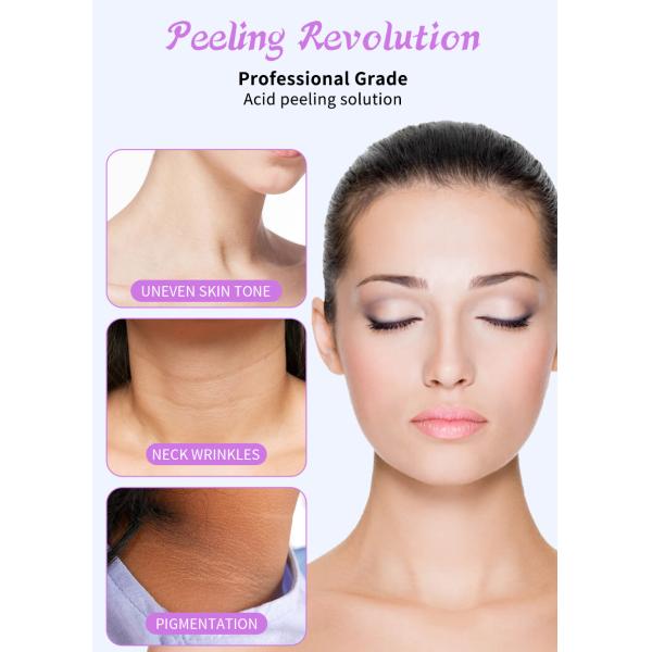 25% Skin Peeling Solution Peeling Revolution Skin Exfoliating Serum