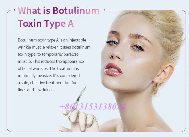 Botulinum токсин Токсин заполнителя 100iu Btx вводимый Botulinum для извлекает морщинки стороны
